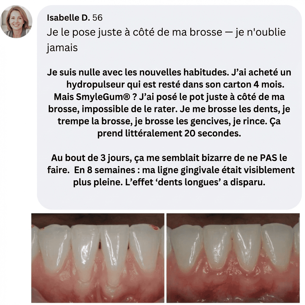 SmyleGum — Gencives saines. Dents blanches. En 2 minutes.