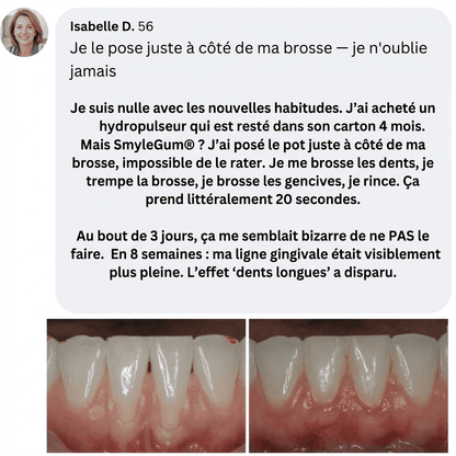 SmyleGum — Gencives saines. Dents blanches. En 2 minutes.