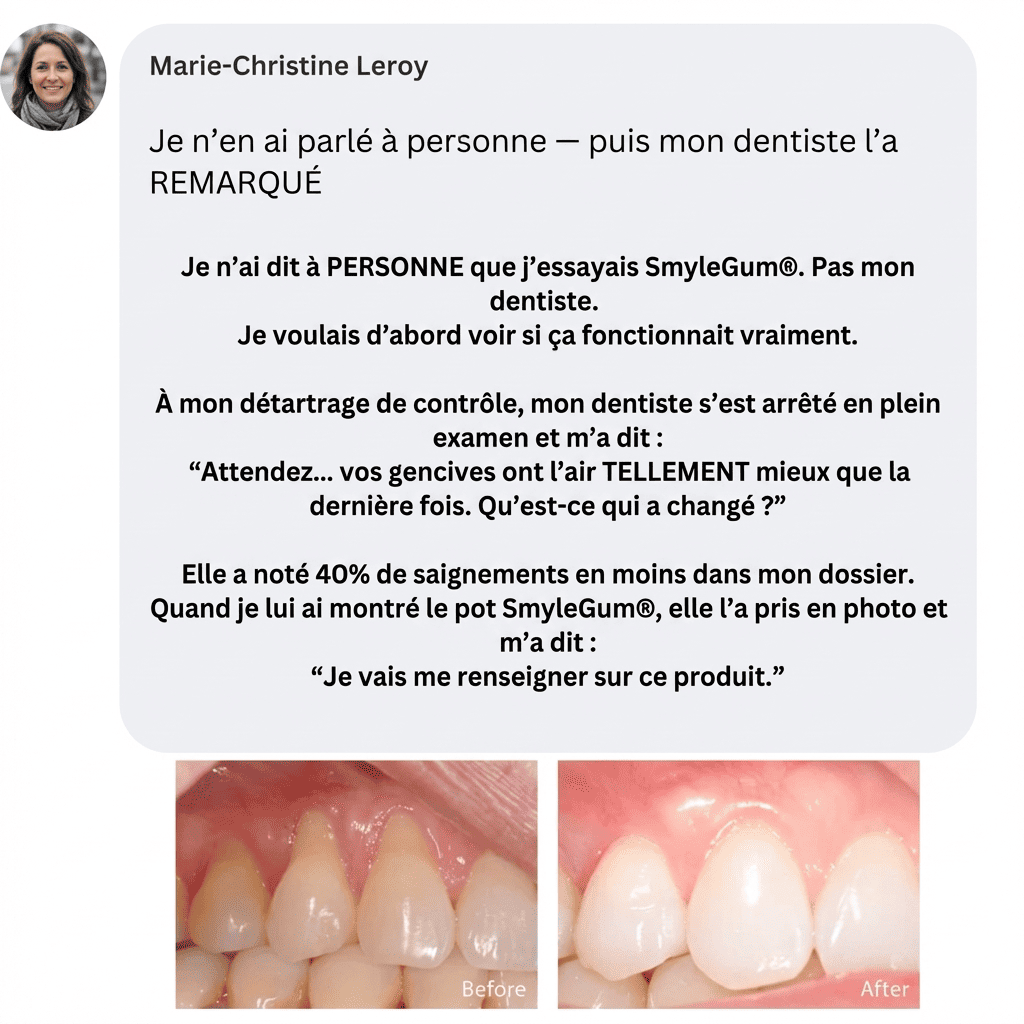 SmyleGum — Gencives saines. Dents blanches. En 2 minutes.