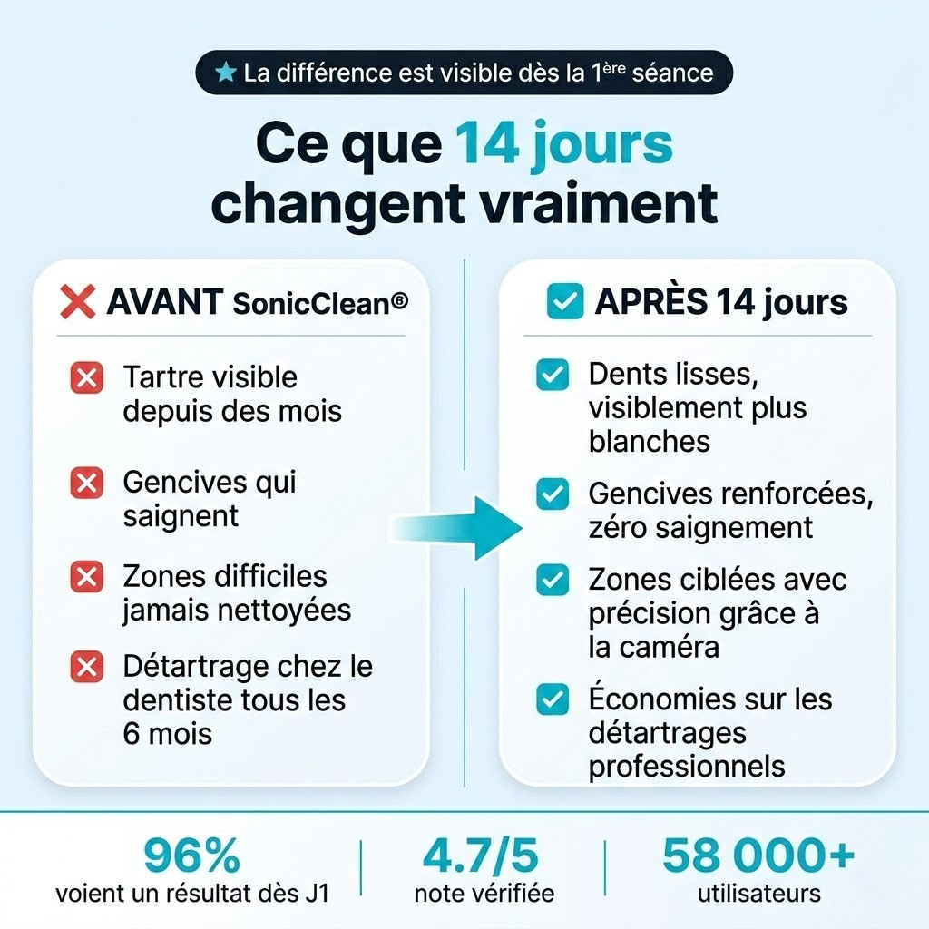 SonicClean — Détartreur à caméra intégré